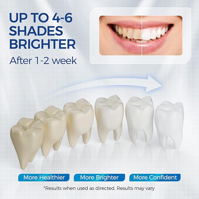 5 x Teeth Whitening Pen Gel (4+1 Desensitizing Gel), No Sensitivity Teeth Whitening Gel Kit, Effective Teeth Whitener, Travel-Friendly Tooth Whitening Pen, Carbamide Peroxide Tooth Bleaching-Ruum Studio Home