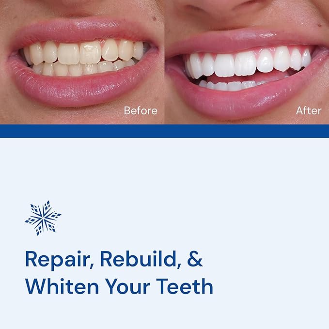Snow Teeth Whitening Kit - Snow Teeth Whitening Serum and LED Mouthpiece Whitener, Formulated with Hydroxyapatite, Good for 2 Months - Wired Kit with 1 Wand-Ruum Studio Home