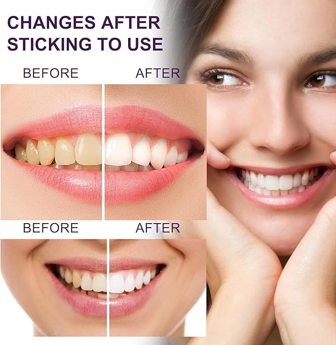 Purple Toothpaste for Teeth Whitening, Purple Whitening Toothpaste for Adults,Tooth Stain Remover Gel - Tooth Whitener Suitable for Smoking, Coffee, and Removing Dental Stone ﻿ ﻿ ﻿-Ruum Studio Home