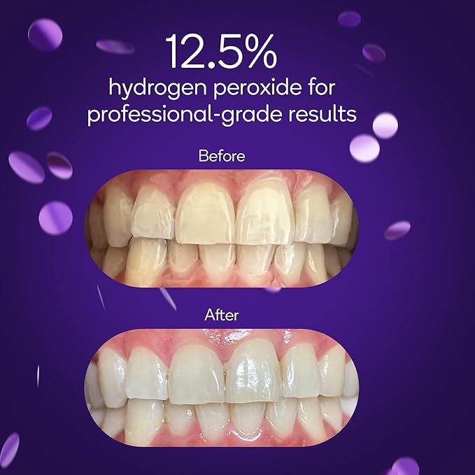 BURST Sensitive Teeth Friendly Whitening Kit | 3 Treatments with 12.5% Hydrogen Peroxide | Up to 3 Shades Whiter After First Use | Prefilled Gel Trays-Ruum Studio Home