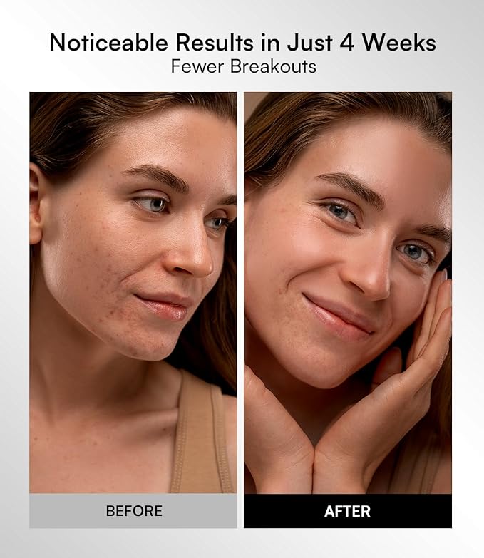 INIA Red Light Therapy Mask for Face – 4 Light Modes with 850nm NIR, Red & Blue LED Light Therapy, 2600mAh Rechargeable LED Face Mask for Anti-Aging, Skin Firming & Radiant Glow at Home-Ruum Studio Home