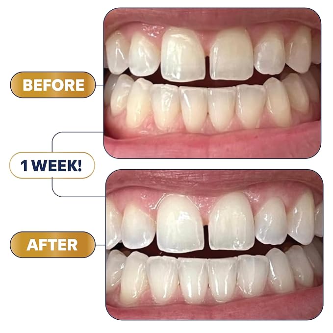 Lumineux 2-in-1 Whitening Pen (1 Pack) Enamel Safe and Clinically Proven to Whiten Without The Sensitivity - Removes Coffee, Tea, and Smoking Stains-Ruum Studio Home