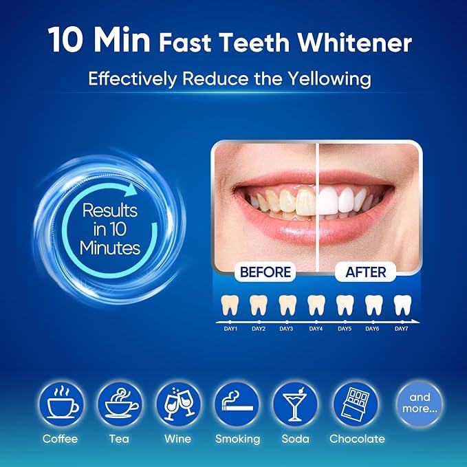 MySmile Teeth Whitening Kit for Sensitive Teeth with LED Light, 10 Min Non-Sensitive Fast Tooth Whitener, 3 Carbamide Peroxide Whitening Gel, Powerful Formula, Enamel Safe-Ruum Studio Home