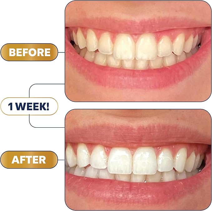 Lumineux Teeth Whitening Strips 21 Treatments – Peroxide Free - Enamel Safe for Whiter Teeth - Whitening Without The Sensitivity - Dentist Formulated - Sensitivity-Ruum Studio Home