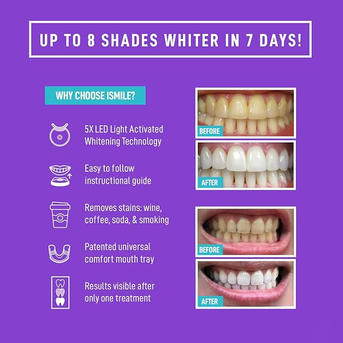 iSmile Teeth Whitening Kit - LED Light, 35% Carbamide Peroxide, (3) 3ml Gel Syringes, (1) Remineralization Gel, and Tray.-Ruum Studio Home