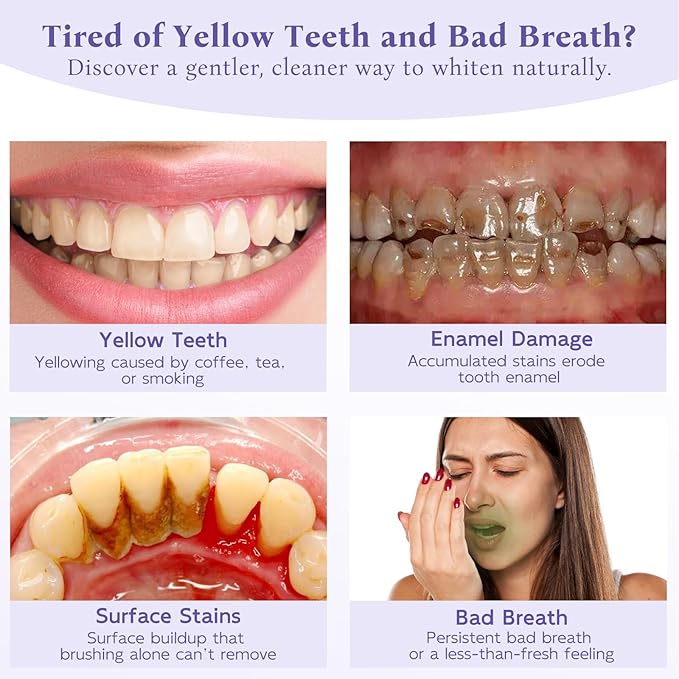 Teeth Whitening Powder,Remineralizing Hydroxyapatite Tooth Powder with Niacinamide,R5X Purple Color Corrector for Instant Brightening, Enamel Repair & Long-Lasting Natural White-30g-Ruum Studio Home