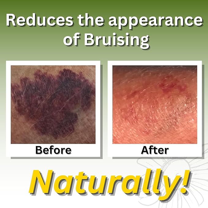 Relief Arnica Cream Natural Lotion for Effective Sore Muscle Relief | Arnica Bruise Cream with Lemongrass & Eucalyptus Essential Oils | Best Massage Lotion for Massage Therapy – 2 Pack-Ruum Studio Home