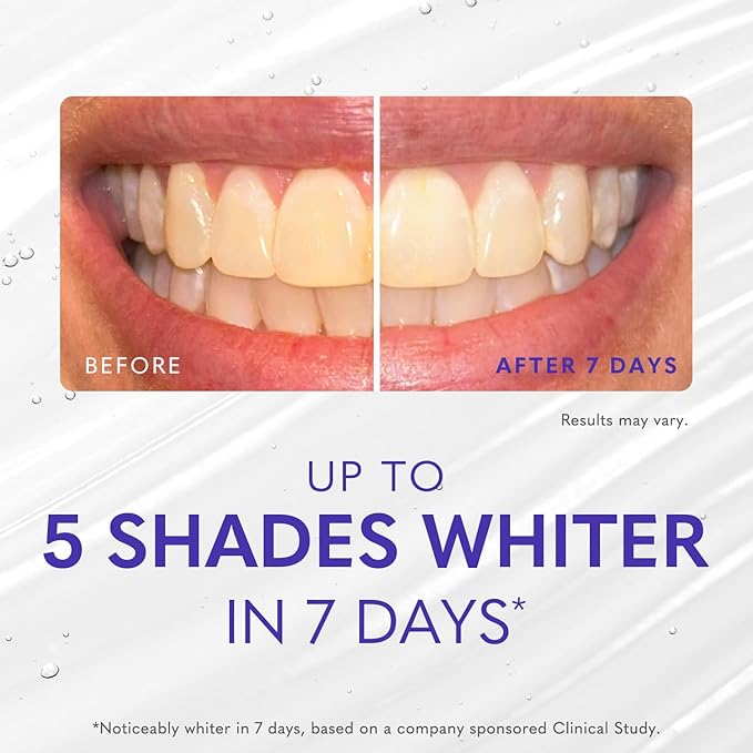 Smileactives Teeth Whitening Gel for Toothpaste with Clinical-Grade Hydrogen Peroxide, Tooth Stain Remover for White Teeth, Dentist Quality Pro Whitening Gel to Remove Stains, 90 Day, 3.8 oz Bottle-Ruum Studio Home