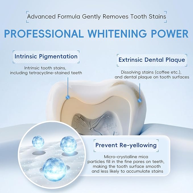 Teeth Whitening Gel- 60ml (2x30ml) Formulated for Sensitive Teeth | Plus Food-Grade Silicone Mouth Tray | Dentist Developed-Ruum Studio Home