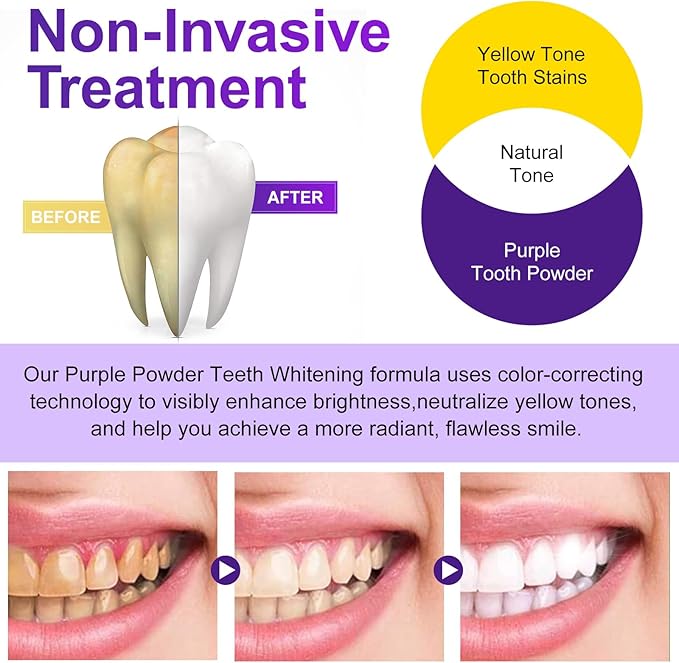 Teeth Whitening Powder - Teeth Whitening - Removes Stains - No Sensitivity - Toothpaste Power - Breath Freshener - for Coffee, Tea and Tobacco Stains 15g-Ruum Studio Home