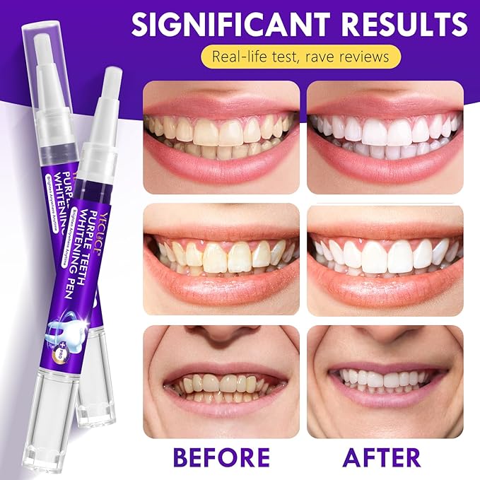 Teeth Whitening Pen 6 Pack, Professional Purple Teeth Whitening Gel for Rapid Stain Removal, No Sensitivity Formula for Sensitive Teeth, Mint Fresh Breath-Ruum Studio Home