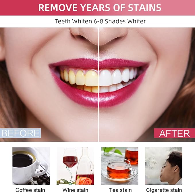 Professional Teeth Whitening Kit with 5 Teeth Whitening Gel, LED Accelerator Light & Rechargeable Design - Enamel Safe Gel, Custom Trays, Fast Results for Sensitive Teeth - Whitening Gel Kit-Ruum Studio Home