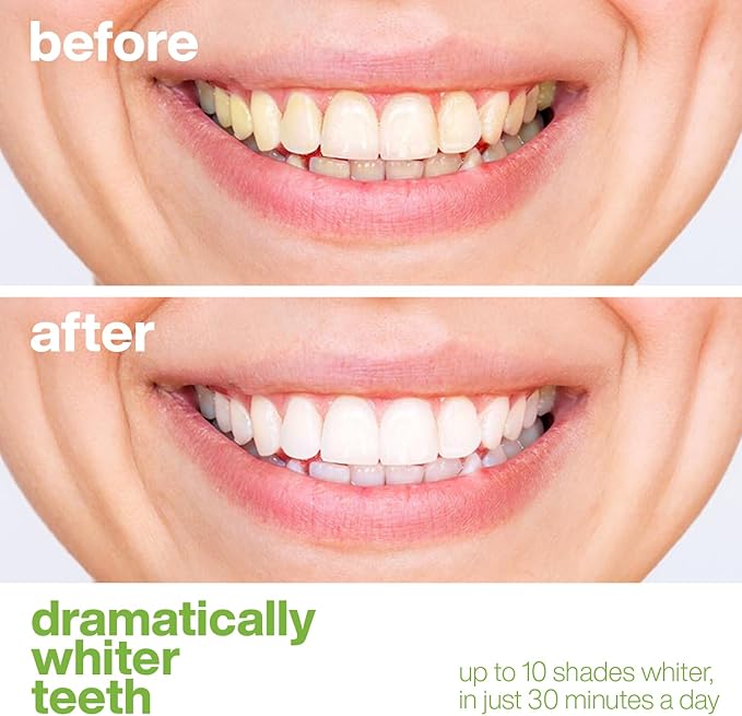 AquaSonic Professional Teeth Whitening Strips - Enamel Safe Teeth Whitening with Hydrogen Peroxide - Easy to Use, Non-Slip, Affordable & Effective (Spearmint)-Ruum Studio Home