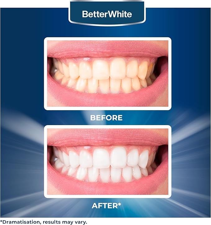 Teeth Whitening Powder - Hydroxyapatite, Remineralizing, Non-Sensitive Formula - Dentist-Approved Tooth Stain Remover & Polisher - Fluoride-Free (30 Grams)-Ruum Studio Home