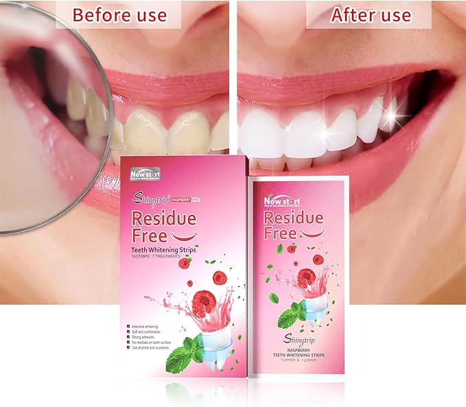Teeth Whitening Strips for Sensitive Teeth - Results in 7 Days, Rave Reviews, Professional, 7 Non-Slip Strips Whitestrip Stains Remover for Coffee, Wine, Tobacco, Smoking-Ruum Studio Home
