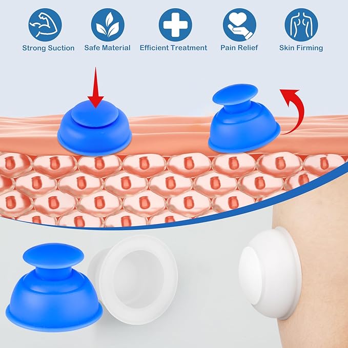 Silicone Cupping Therapy Sets 10pcs,Professional Vacuum Cupping for Myofascial Massage/Joint Pain/Anti Cellulite/Deep Muscle Relief & More(10pcs,White+Blue)-Ruum Studio Home