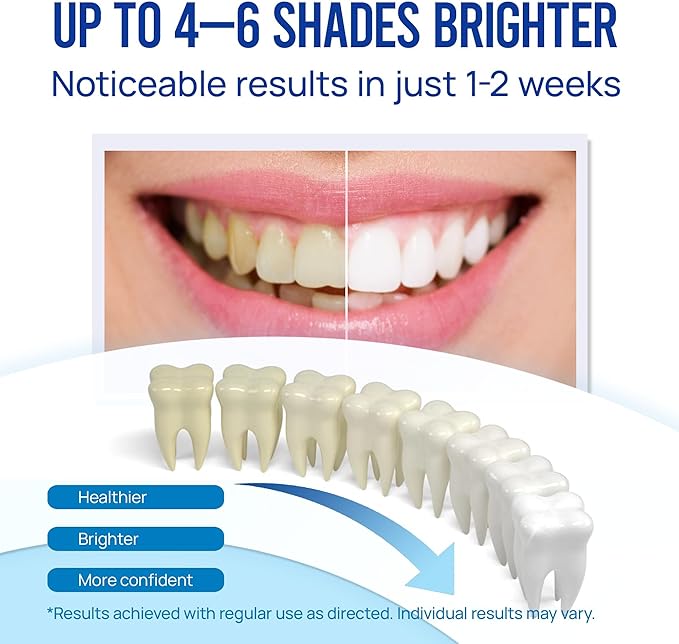 Teeth Whitening Pen Gel Kit: 35% Carbamide Peroxide Gel for Stain Removal - No Sensitivity with Remineralizing Pen for a Brighter Whiter Smile Mint-Ruum Studio Home