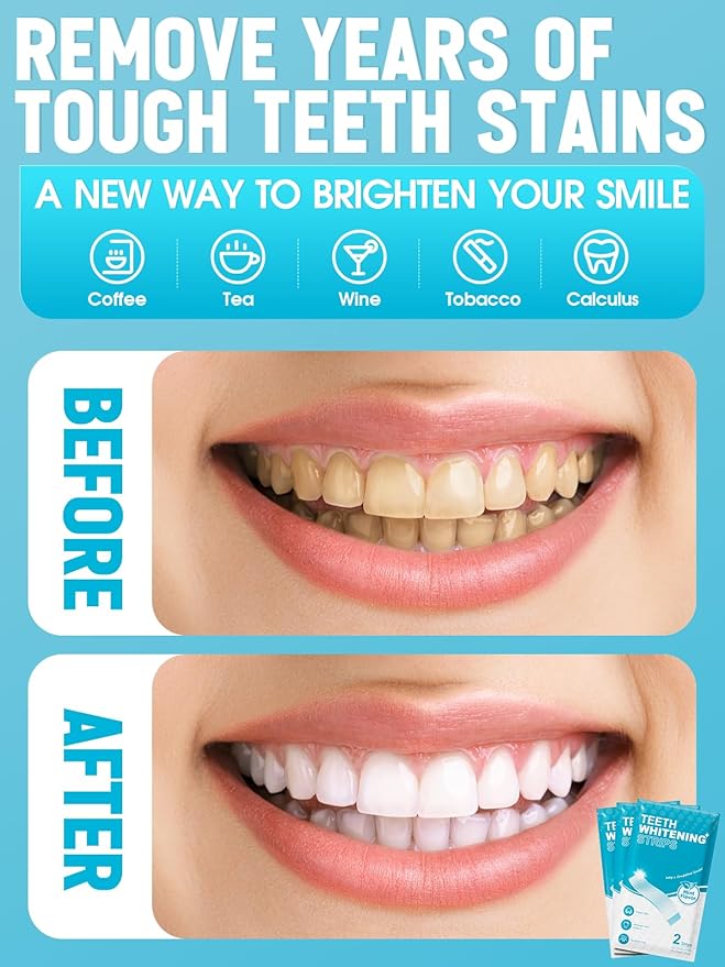 Oralfree Natural Teeth Whitening Strips - Sensitive Teeth Whitener - Enamel Safe Teeth Whitening Kit with Hydrogen Peroxide for Coffee, Wine, Tobacco, and Other Stains, 28 Strips (14 Treatment), Mint-Ruum Studio Home
