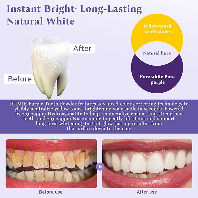 Teeth Whitening Powder,Remineralizing Hydroxyapatite Tooth Powder with Niacinamide,R5X Purple Color Corrector for Instant Brightening, Enamel Repair & Long-Lasting Natural White-30g-Ruum Studio Home