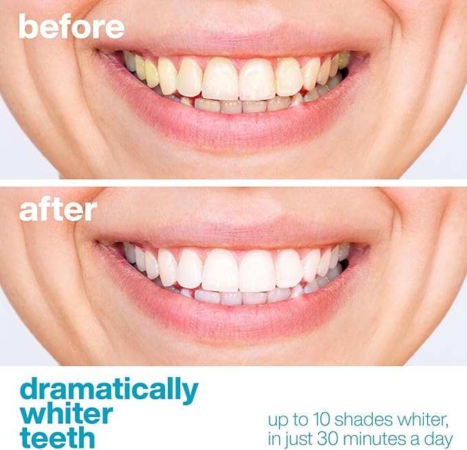 AquaSonic Professional Teeth Whitening Strips - Enamel Safe Teeth Whitening with Hydrogen Peroxide - Easy to Use, Non-Slip, Affordable & Effective (Unflavored)-Ruum Studio Home