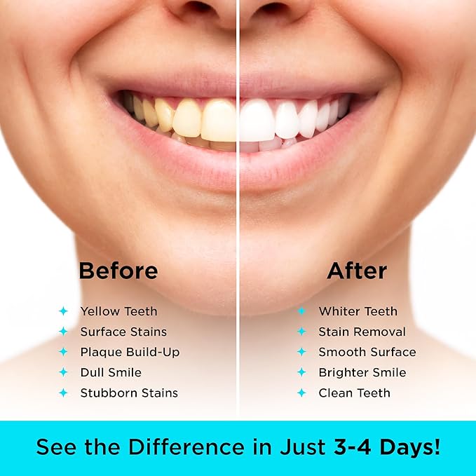 CARBON WHITE Teeth Whitening Powder - Natural Activated Coconut Charcoal Tooth Powder for Removing Stains & Discoloration - Helps Fight Tartar & Plaque, Freshens Breath - Tasteless, Odorless - 30g-Ruum Studio Home