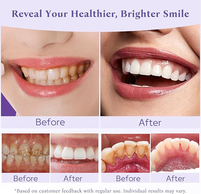 Teeth Whitening Powder,Remineralizing Hydroxyapatite Tooth Powder with Niacinamide,R5X Purple Color Corrector for Instant Brightening, Enamel Repair & Long-Lasting Natural White-30g-Ruum Studio Home