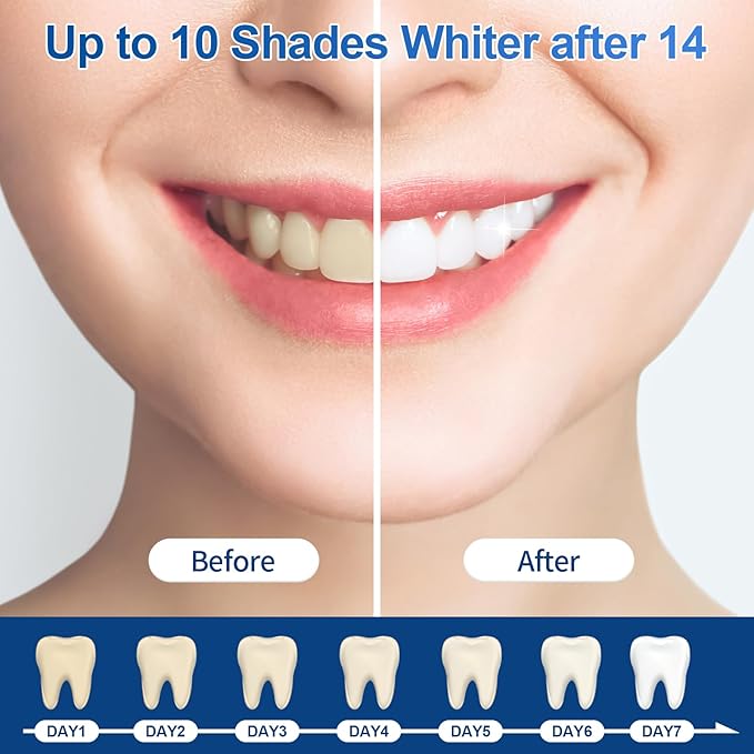 10-Pack Teeth Whitening Gel Refills - Gentle 35% Carbamide Peroxide Formula - Compatible with Teeth whitening Kit,No Sensitive Teeth Whitener-Ruum Studio Home