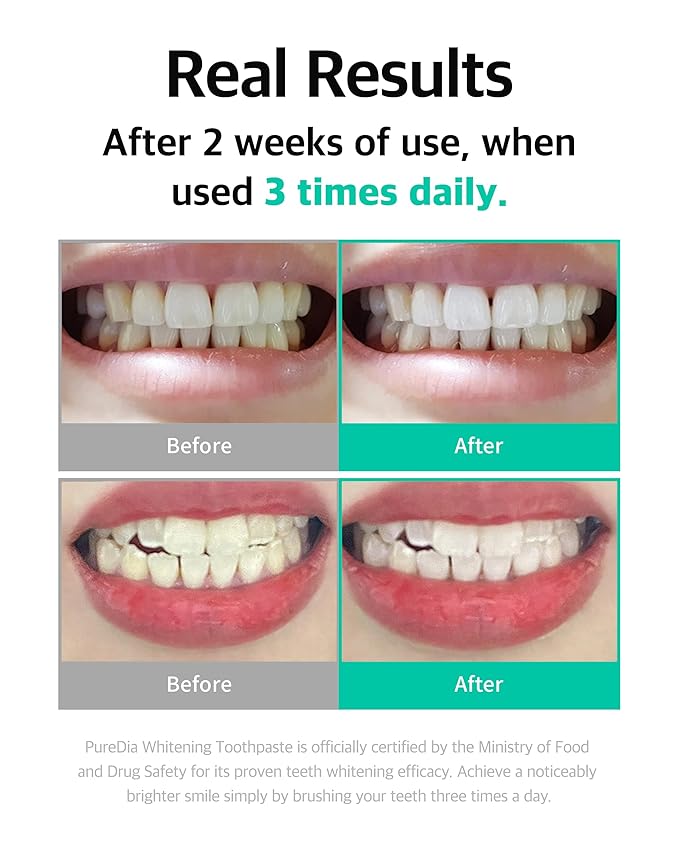 Live Orals Whitening Toothpaste 80g x 5 Units - Fluoride-Free Stain Removal, Strengthens Enamel, Natural Ingredients, Fresh Mint Flavor-Ruum Studio Home