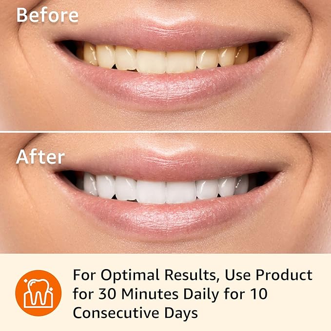 Amazon Basics 10 Day Teeth Whitening Strips Kit, 10 Treatments, 1-Pack (Previously Solimo)-Ruum Studio Home