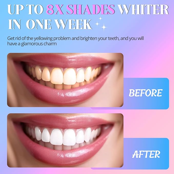 Teeth Whitening Strips White Strip - 28 Pcs Sensitive Whiten Stripe, Natural Enamel Safe Non-Slip Dry Product,30 Minutes Fast Effects Tooth Whitener,14 Treatments Mint Kit for Home Family Travel Work-Ruum Studio Home