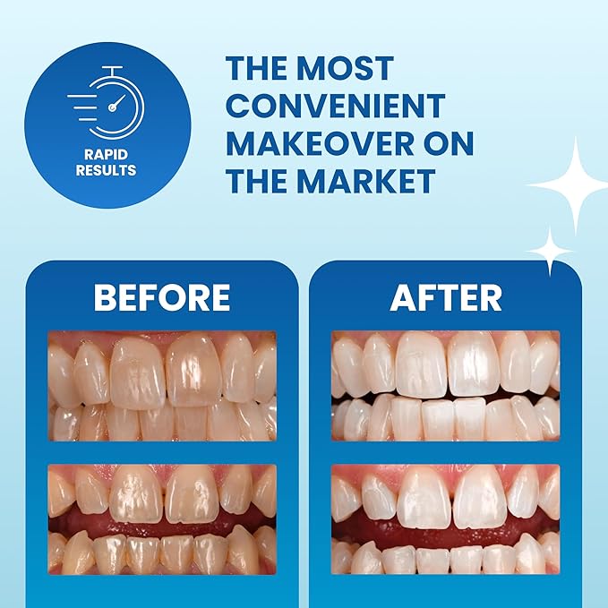 POOOF! Dissolving Teeth Whitening Strips by Dr. Bill Dorfman | 12% Hydrogen Peroxide | No-Slip Melt-Away Advanced Seal | Fast Stain Removal | Enamel & Sensitive Safe | 20 Ct (10-Day) | Polar Mint-Ruum Studio Home