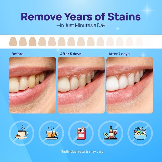 Whitebite Pro Upgraded Teeth Whitening Strips 14 Strips (7 Treatments) | Enamel-Safe | Deep Stains Removal | Non-Slip Design | Whitening Without Any Harm | Mint-Ruum Studio Home