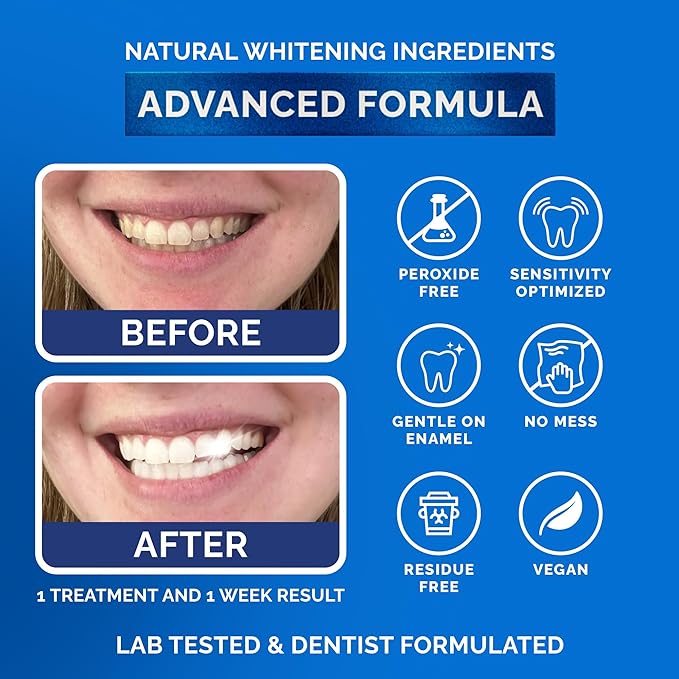 Whitening Strips for Sensitive Teeth 7 Treatments, Mint – Enamel Safe, Peroxide-Free Coconut Teeth Whitening Strips with Natural Enzymes – Gentle White Stips for Sensitive Gums & Daily Oral Care-Ruum Studio Home