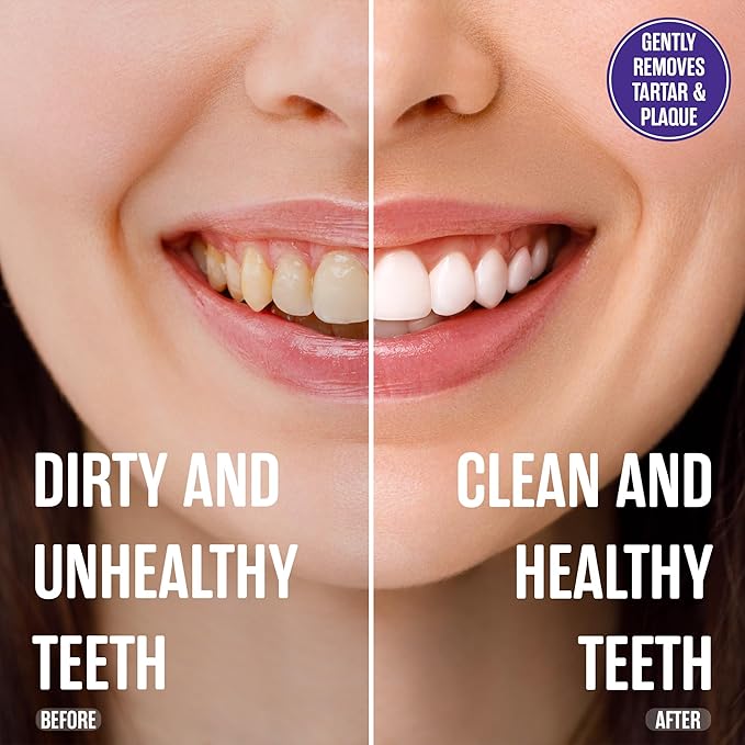 SprinJene Fluoride Free Toothpaste for Sensitive Teeth & Gum Fresh Breath Helps Dry Mouth Natural Non Fluoride Toothpaste for Adult SLS Free, Toxic Preservative Free with Black Seed Oil & Zinc 4 Pack-Ruum Studio Home