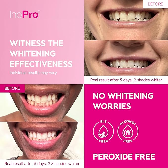 Teeth Whitening Strips 14 Treatments Kit - Teeth Whitener, Peroxide Free, Enamel Safe Green White Strips, Deep Stains Removal - Instant Teeth Whitening Without The Harm (28 Strips)-Ruum Studio Home