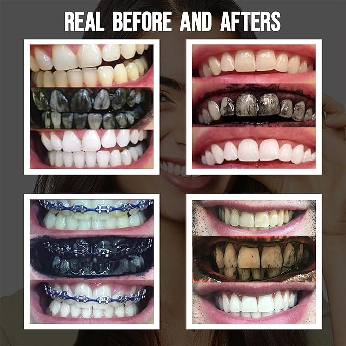Premium Activated Charcoal Natural Coconut Teeth Whitening Powder - Safe for Enamel to get a Whiter and Brighter Smile - Organic Toothpaste Detoxifier-Ruum Studio Home