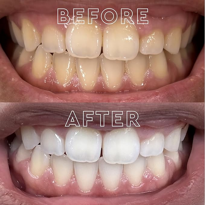 MOON Dissolving Teeth Whitening Strips - Vegan, Easy-to-Use White Strips - Dissolve in 15 Minutes & Designed to Gently Whiten Sensitive Teeth Up to 7 Shades in 2 Weeks, Midnight Mint (56 Count)-Ruum Studio Home