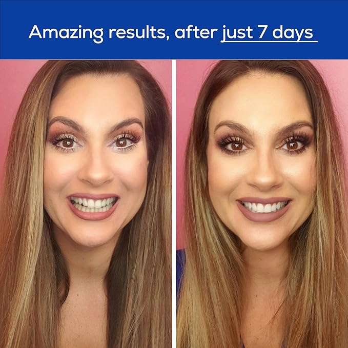 GLO Science Teeth Whitening Gel – 6% Hydrogen Peroxide – Clinically Proven, Fast & Safe for Sensitive Teeth – Includes 10 Gel Vials & 1 Lip Care-Ruum Studio Home