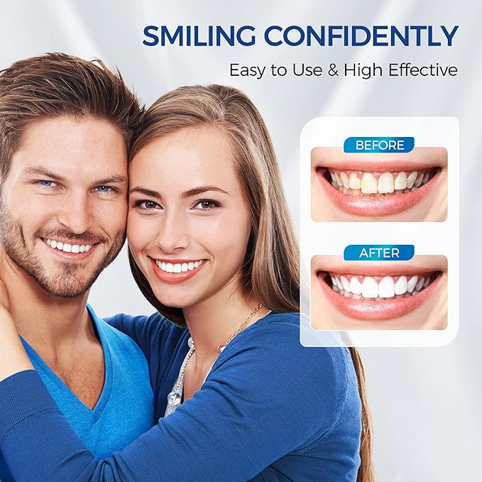 Teeth Whitening Kit for Sensitive Teeth,with 4 Carbamide Peroxide Pen & 1 Remineralization Pen,LED Accelerator Light Non,Tooth Whitener Professional Oral Care Gently Yet Effectively Removes Stains-Ruum Studio Home