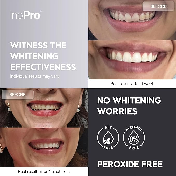 Natural Teeth Whitening Strips Kit 14 Treatments - Sensitive Teeth Whitener, Peroxide Free, Enamel Safe White Strips - Instant Teeth Whitening Without The Harm (28 Strips)-Ruum Studio Home