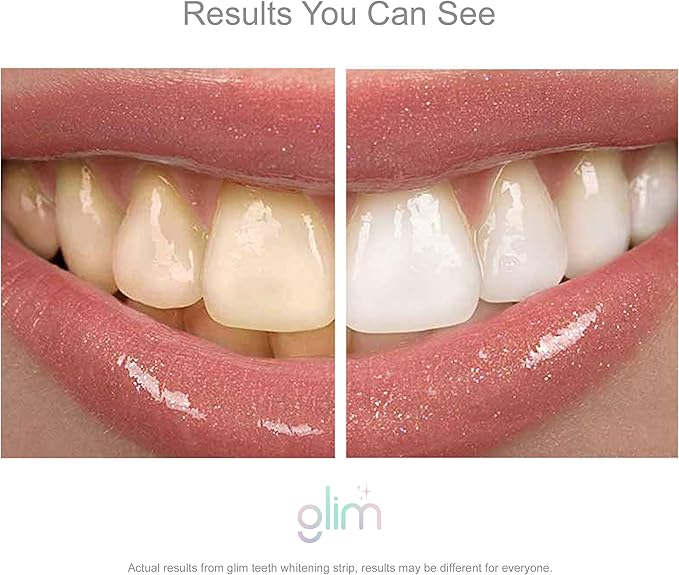 Glim Professional Teeth Whitening Strips| 42 Strips (21 Treatments), Hydrogen-Free, Peroxide-Free, Non-Toxic, Dentist Recommended, Sensitivity Free - Vegan & Cruelty Free - (Mint)-Ruum Studio Home