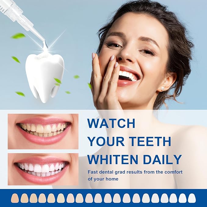 LUCKIN SMILE 10*3ML Teeth Whitening Gel Refill with 22% Carbamide Peroxide Suitable for Sensitive Teeth Whitening, 60 Whitening Treatments, Teeth Whiteners Used in Conjunction with Teeth Whitening Kit-Ruum Studio Home