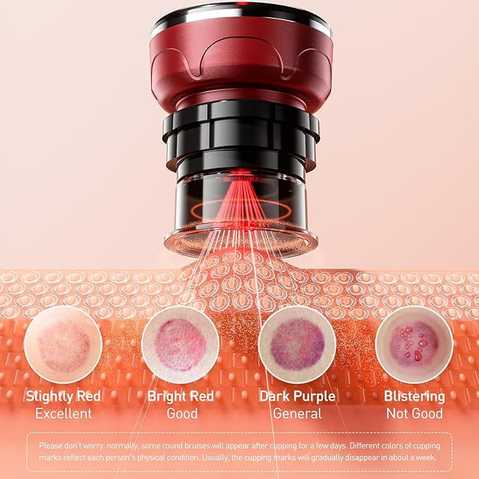 UBALANCE Smart Cupping Therapy Set - Cellulite Massager with 6 Massage Cups, Portable Electric Device for Enhanced Blood Circulation, Reduced Cellulite, and Muscle Soreness Relief（Red）-Ruum Studio Home
