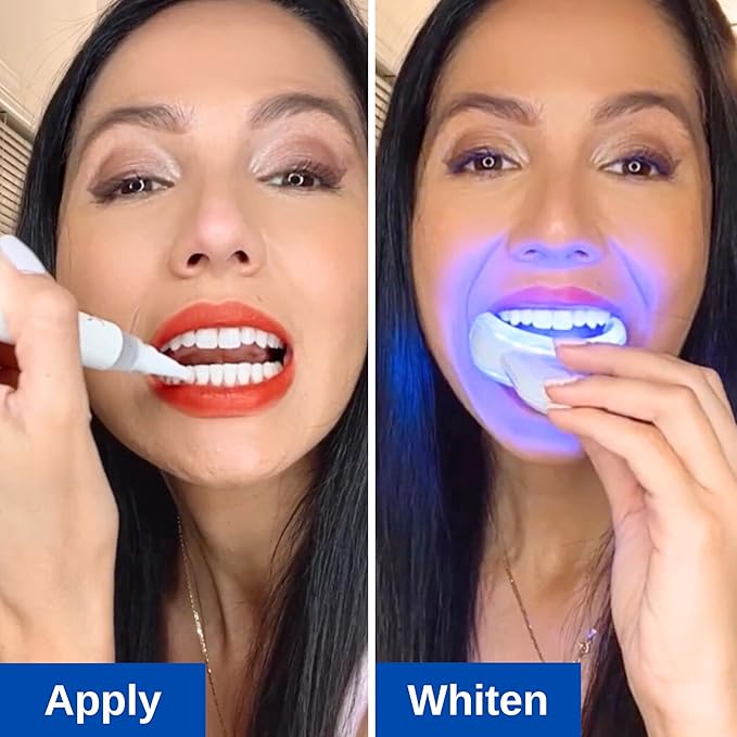 Polar MD Teeth Whitening Kit, Professional Teeth Whitener Gel Pens, 1YR. Supply, Compare to Whitening Strips. Powerful 32 LED Wireless Activating Light.-Ruum Studio Home