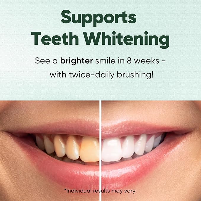 MySmile Fluoride Free Toothpaste, Nano Hydroxyapatite Toothpaste for Sensitive Teeth, Strengthens Enamel, Remineralizes & Whitens Teeth, Freshens Breath for Adults, SLS Free, Natural Misty Mint, 4.2oz-Ruum Studio Home