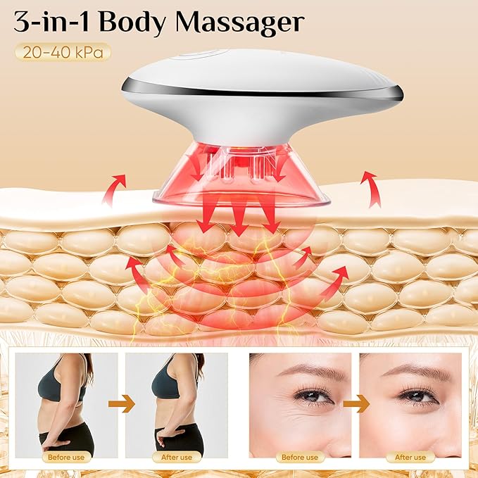 Body Smart Scraping - 3 in 1 Body Sculpting Machine - Best Cellulite Removal Machine- Body Sculptor，Suitable for Legs, Abdomen, Arms, Love Handles, Relieves Muscle Tension and Tightens Skin-Ruum Studio Home