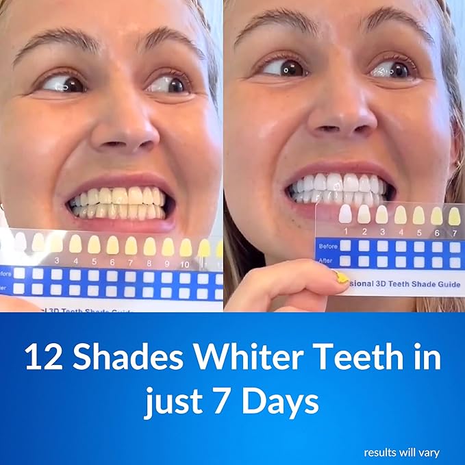 Polar MD Teeth Whitening Kit, Professional Teeth Whitener Gel Pens, 1YR. Supply, Compare to Whitening Strips. Powerful 32 LED Wireless Activating Light.-Ruum Studio Home