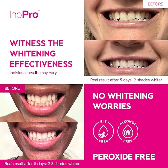 Teeth Whitening Strips 21 Treatments Kit - Teeth Whitener, Peroxide Free, Enamel Safe Green Whitestrips, Deep Stains Removal - Instant Teeth Whitening Without The Harm (42 Strips)-Ruum Studio Home