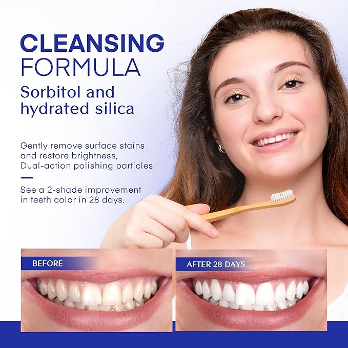 PearlSmile Hydroxyapatite Niacinamide Whitening Toothpaste – 5% Niacinamide + 10% Nano-Hydroxyapatite (nHAp) – Strengthens Enamel & Remineralizes – Fluoride-Free, 4.2oz (Pack of 1)-Ruum Studio Home